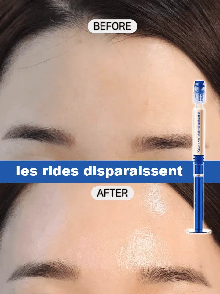 Crème de collagène de remplissage de tube d'aiguille de polypeptide.