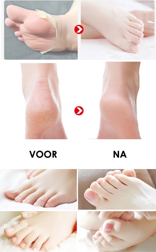 Masque exfoliant pour les pieds